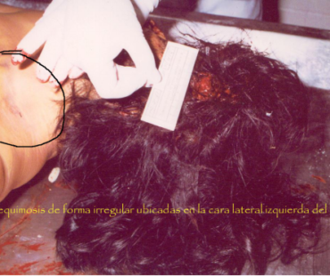 Case of Digna Ochoa, Mexico